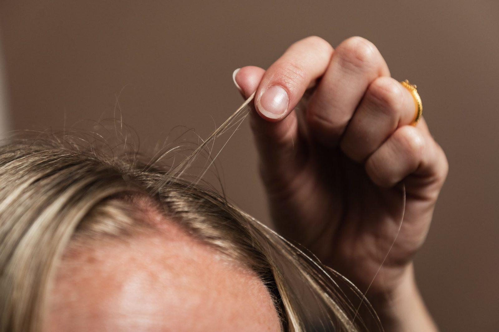 Hud- og hårnapping (trikotillomani) er en psykisk lidelse preget av trang til å nappe hår eller plukke i huden.